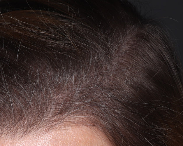 Después - 8 semanas con Strong Hair