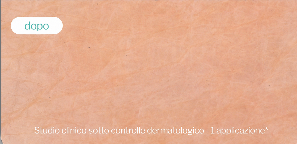 Dopo