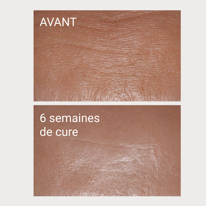 Collagène+