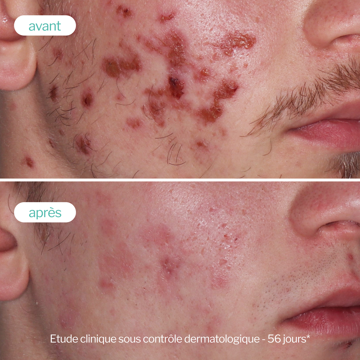 Routine anti-imperfections