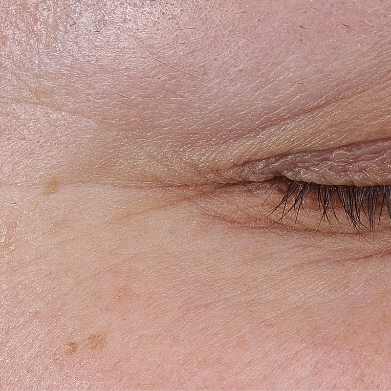 Après